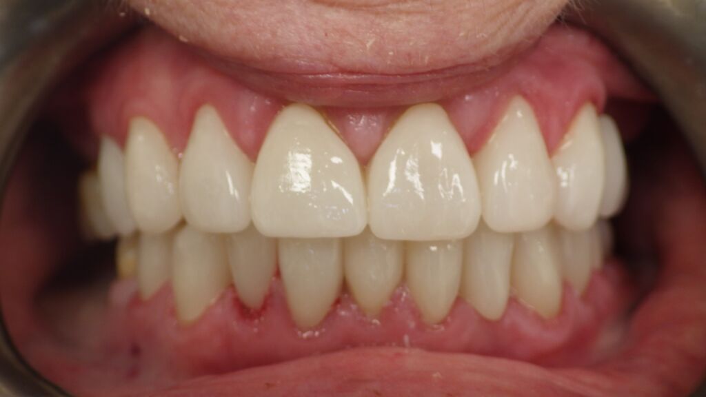 Smile Gallery - MANGO DENTAL