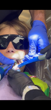 Laser Fillings - MANGO DENTAL Laser Fillings in Greensboro NC