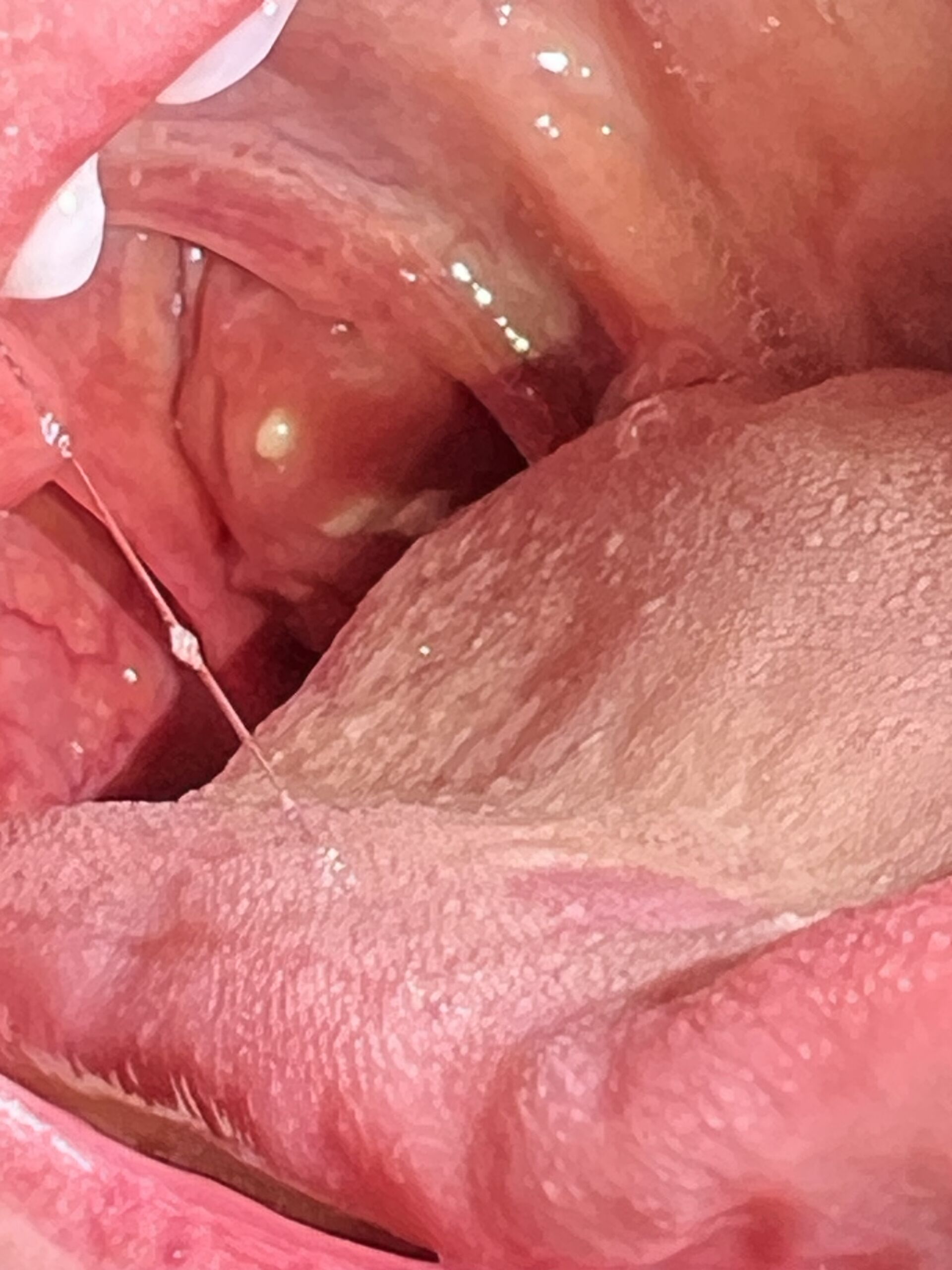 Close-up of an open mouth with pink lips and the tongue visible inside.